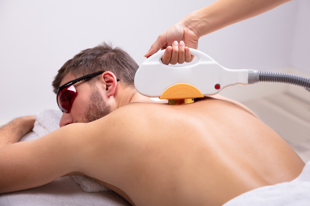 Is Laser Hair Reduction Effective? laser hair reduction effective