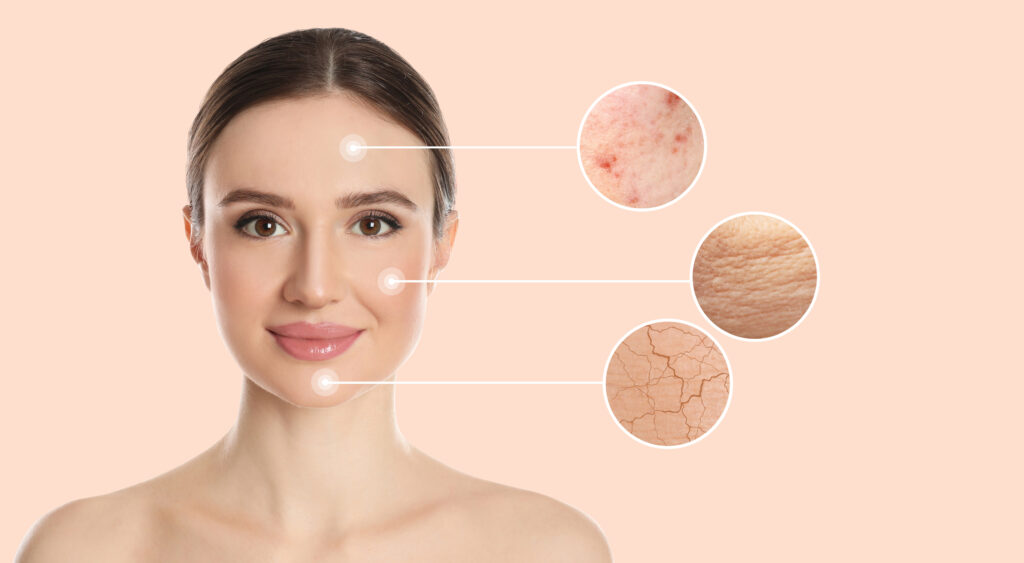 Determining and Understanding Your Skin Type Determining and Understanding Your Skin Type